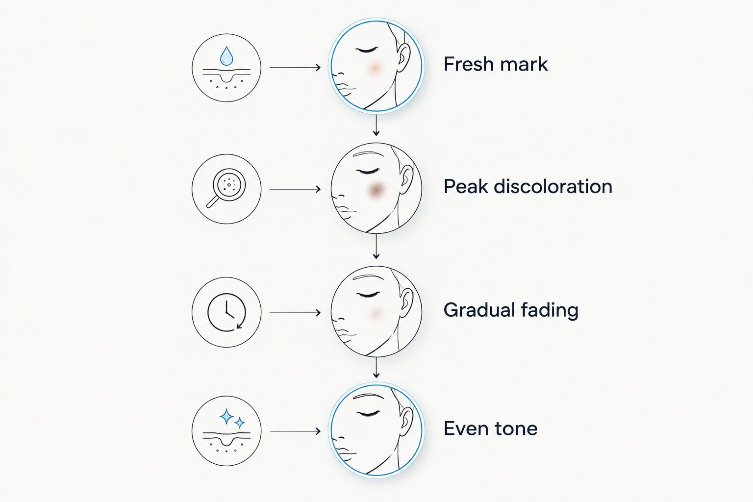 Timeline showing four stages of how a dark spot fades over time