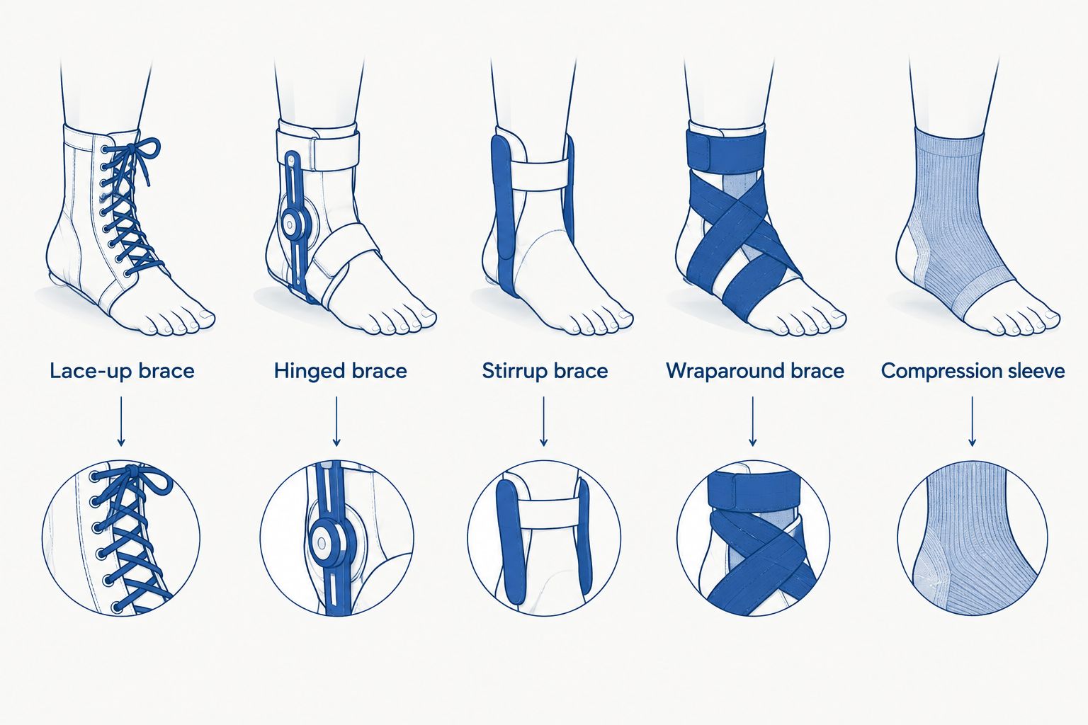 Comparison of lace-up, hinged, stirrup, wraparound, and compression ankle supports