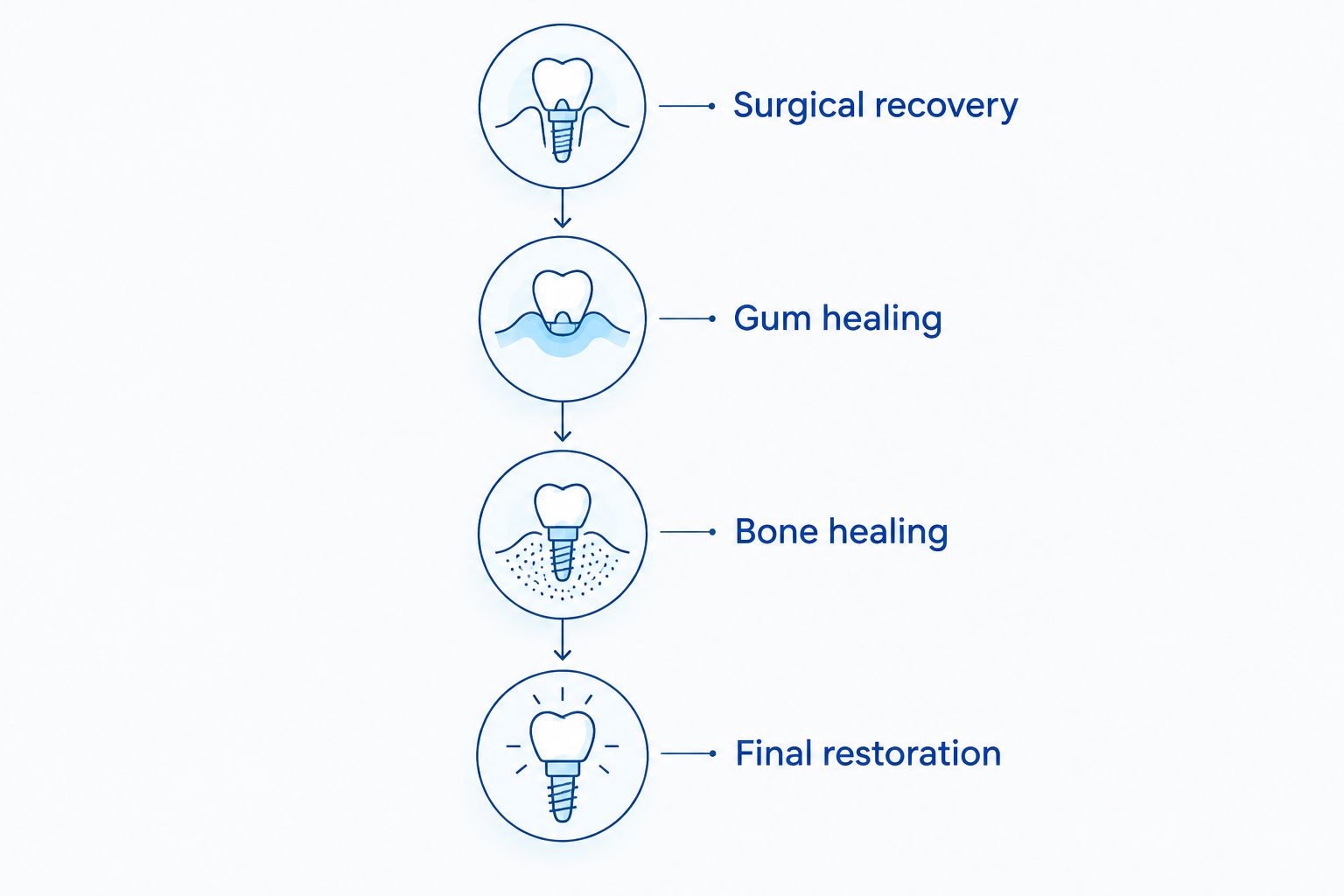 Recovery phases from surgical recovery through gum healing, bone healing, and the final restoration
