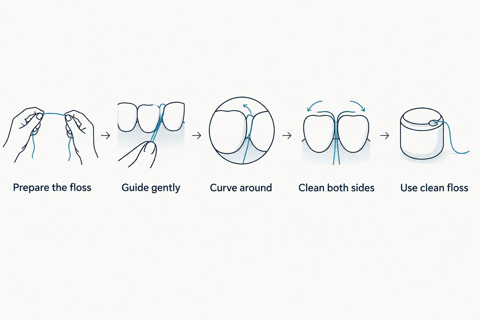 Five steps for guiding floss gently and cleaning both sides of each space between teeth