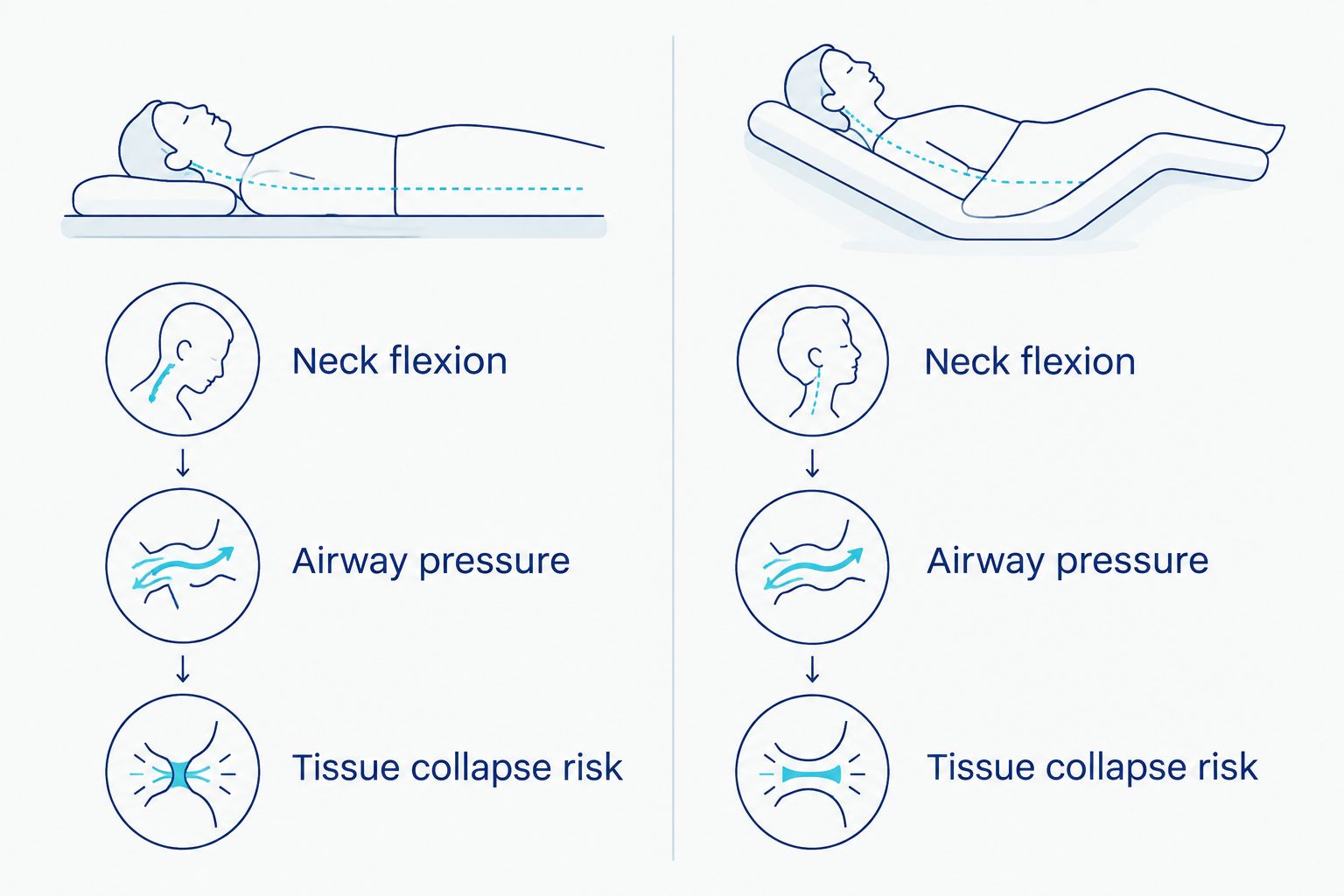 Comparison diagram of flat sleeping versus zero gravity recline position for airway pressure