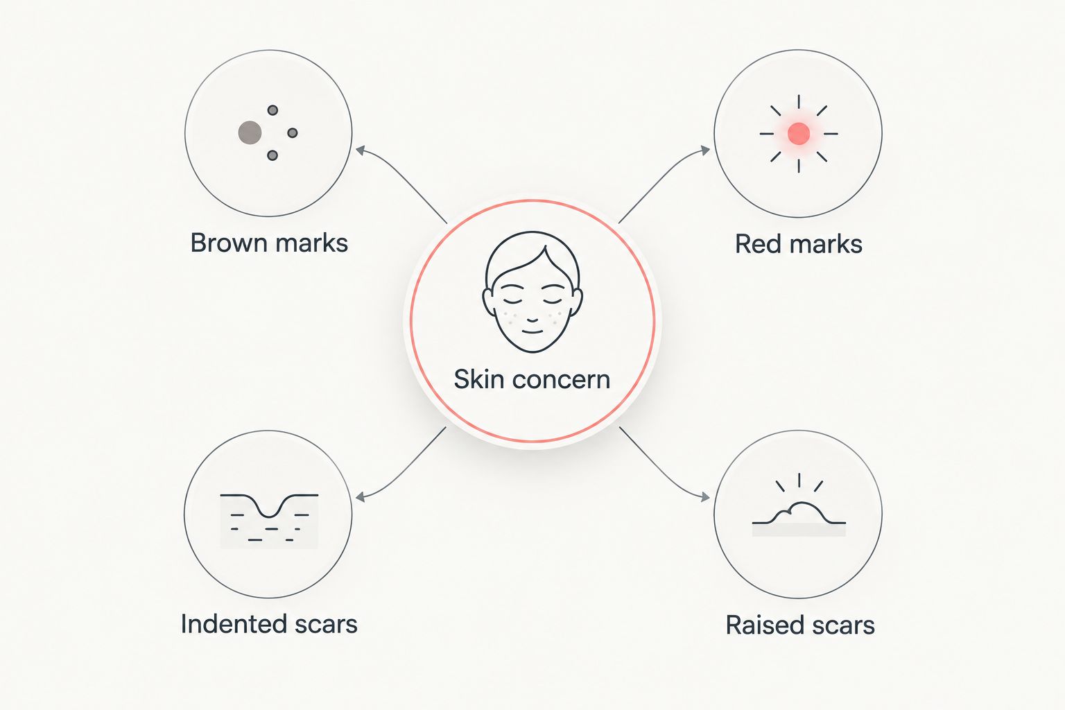 Four skin concerns to distinguish before choosing an acne-scar skincare routine