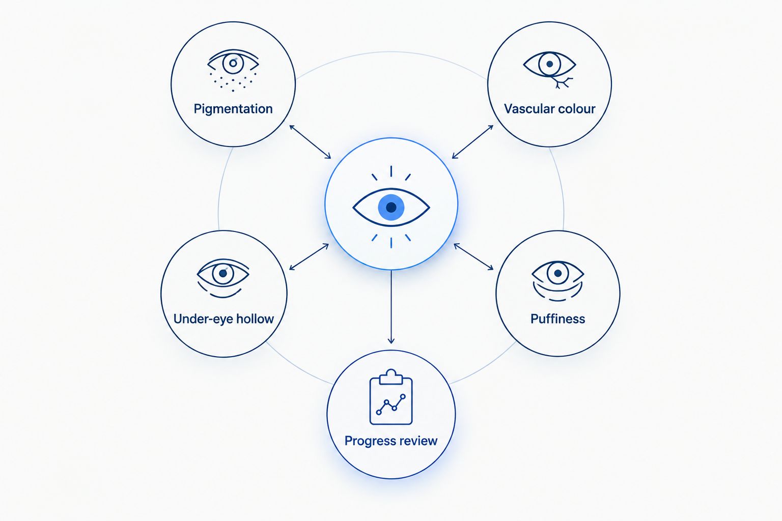 Diagram of four contributors to dark circles connected to a progress review