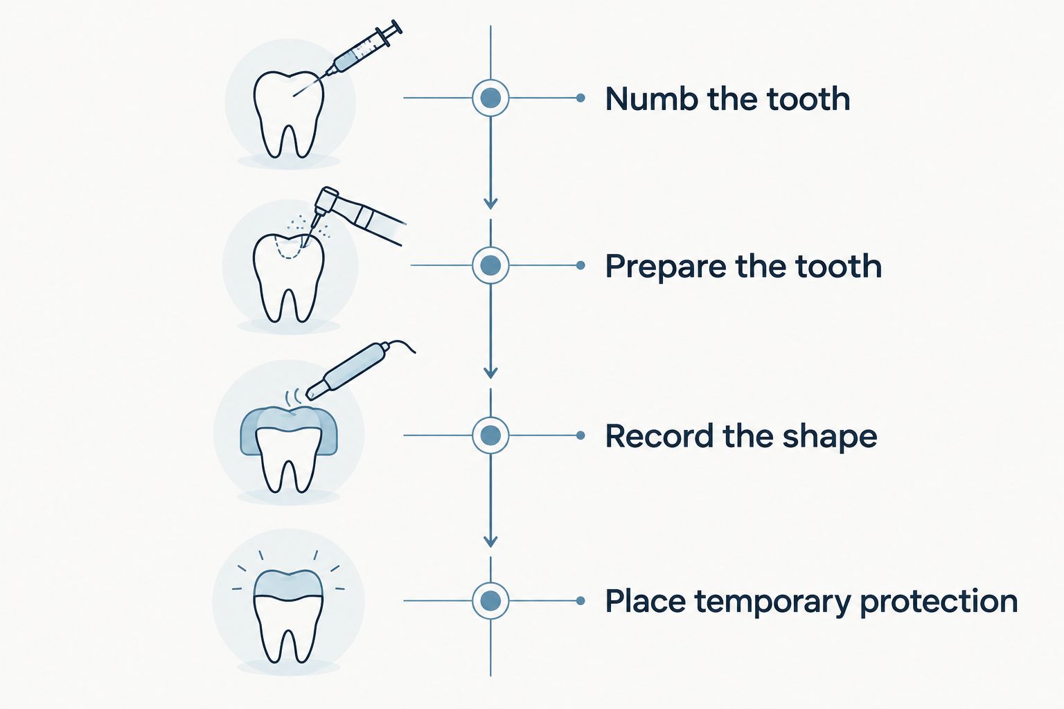 Four stages of the first crown appointment, from numbing the tooth to temporary protection