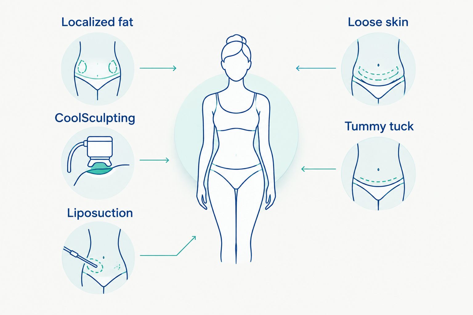 Diagram comparing options for localized fat and loose abdominal skin