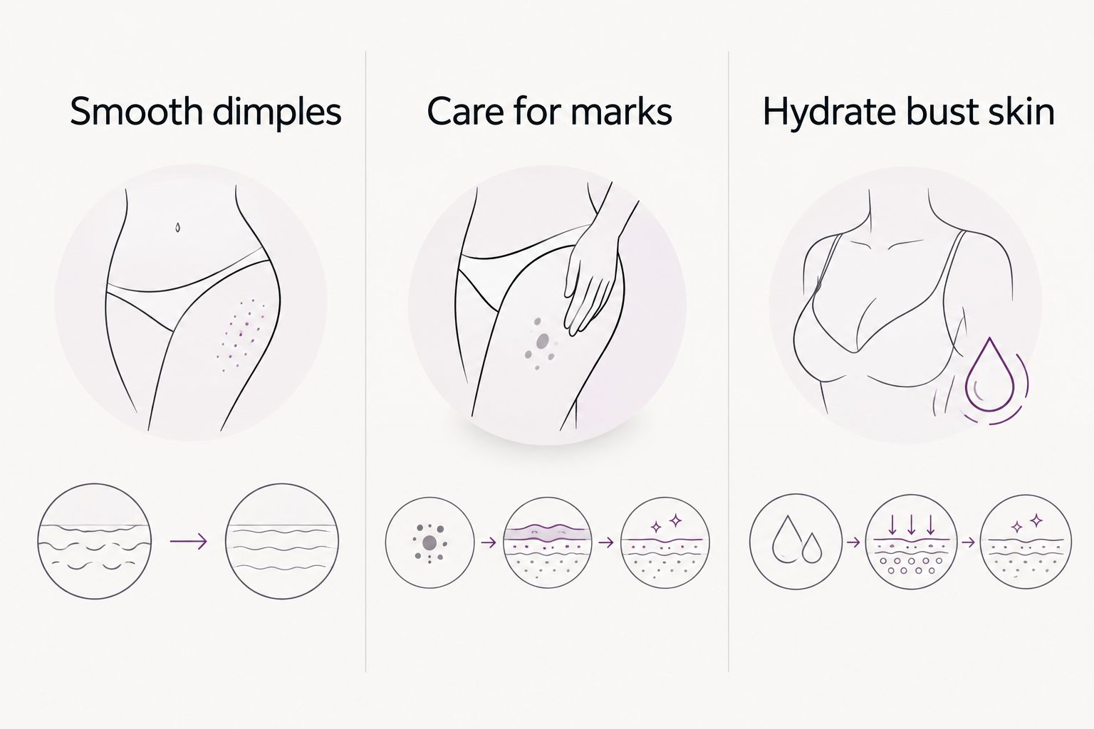 Three distinct cream purposes: dimple-focused smoothing, stretch-mark care, and bust-area hydration.