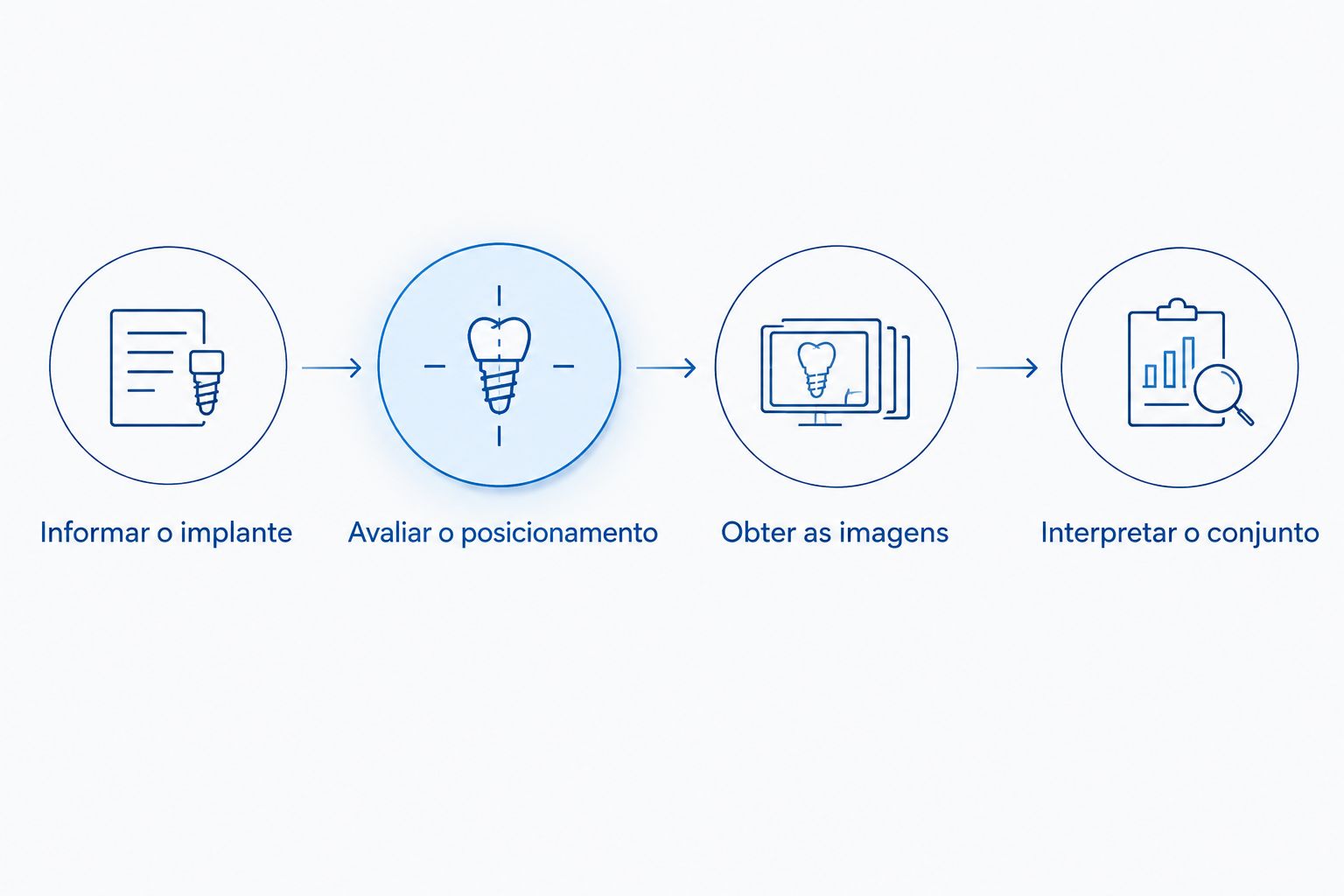 Etapas da mamografia com prótese, da informação sobre o implante à interpretação das imagens.