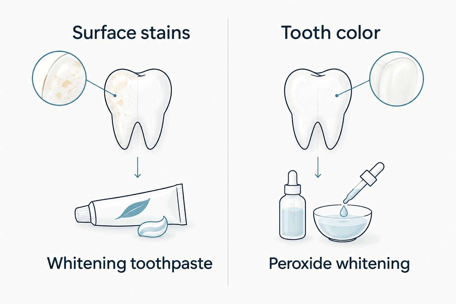 Comparison of whitening toothpaste for surface stains and peroxide whitening for natural tooth color