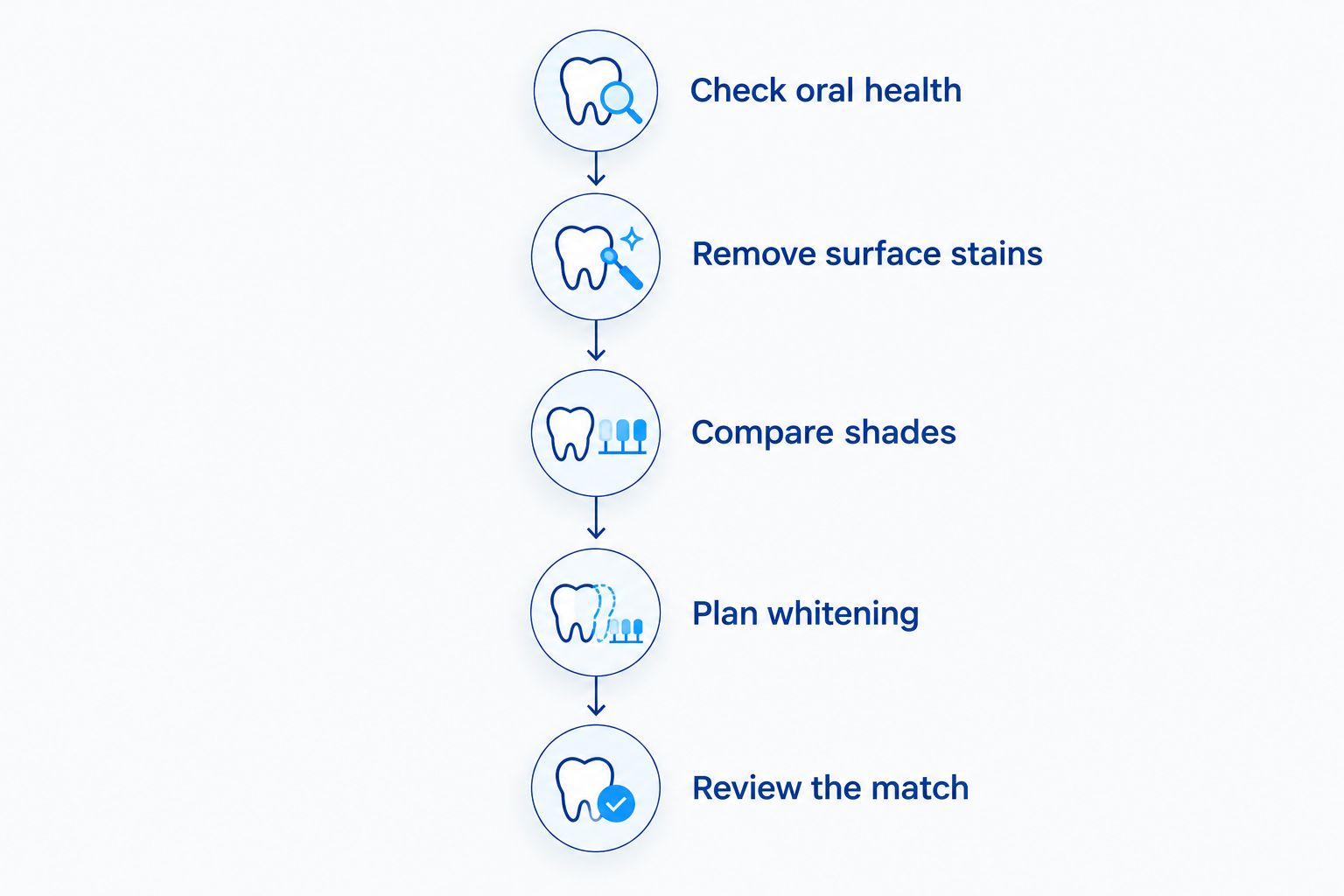 Five stages for planning natural-tooth whitening around existing veneers