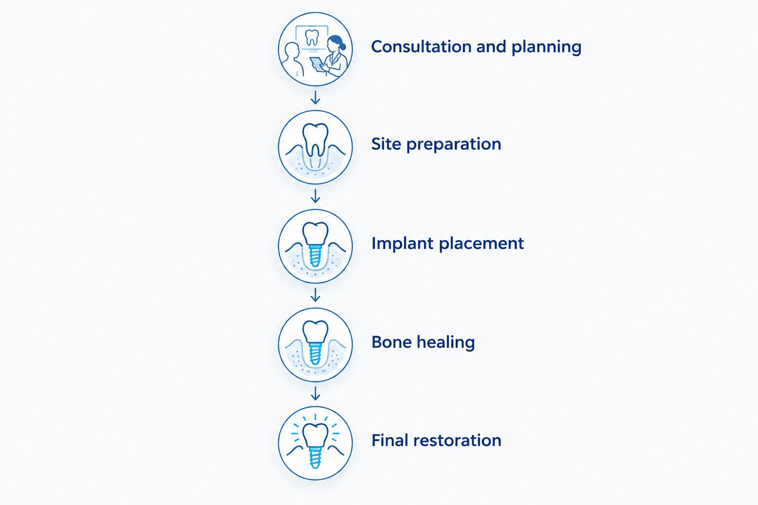 Dental implant stages from consultation and site preparation through bone healing and final restoration.