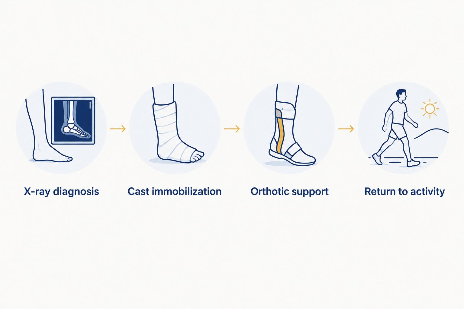 Four-step treatment flow for Kohler's disease from diagnosis to return to activity