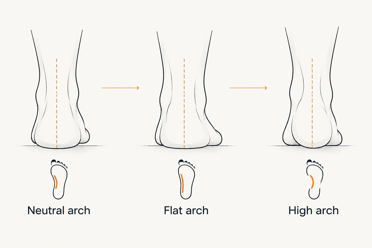 Three foot arch types compared: neutral, flat and high arch