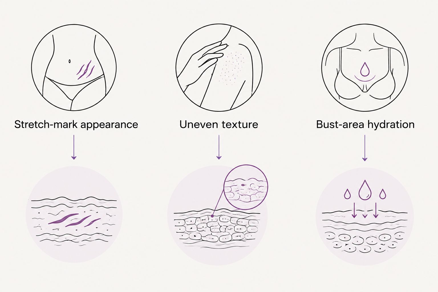 Three distinct body-care goals: stretch-mark appearance, uneven texture, and bust-area hydration