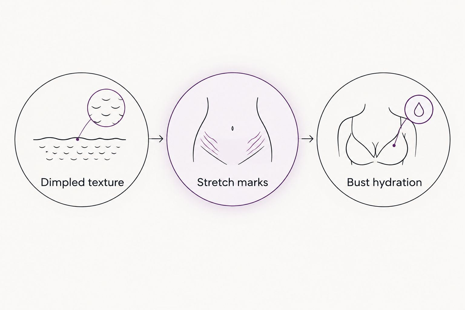 Three distinct body-care goals: dimpled texture, stretch marks, and bust hydration
