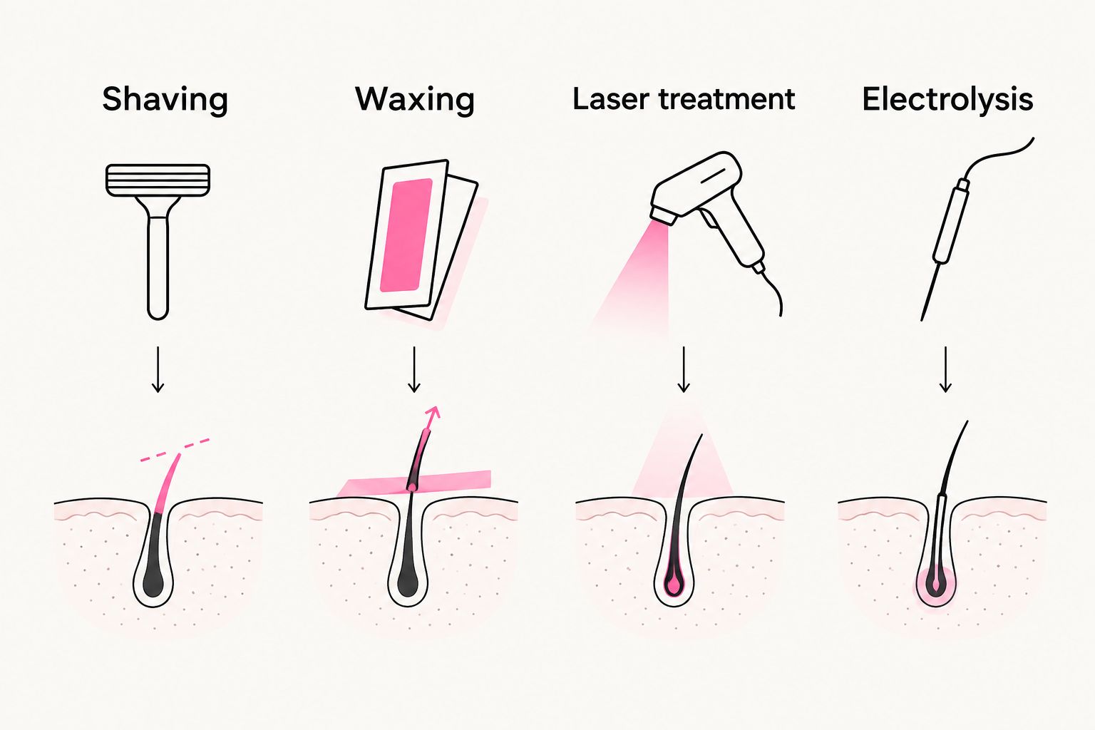 Four grooming options: shaving, waxing, laser treatment, and electrolysis