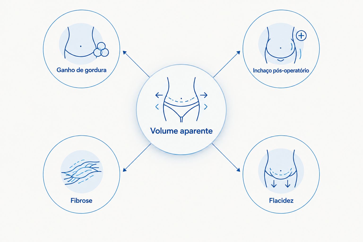 Diagrama com causas diferentes de volume aparente após lipoaspiração.