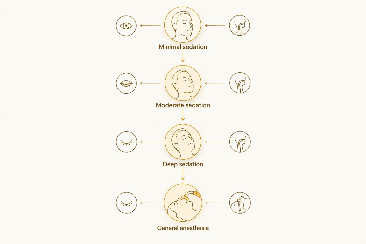 Four levels from minimal sedation to general anesthesia, showing increasing depth and airway support needs.