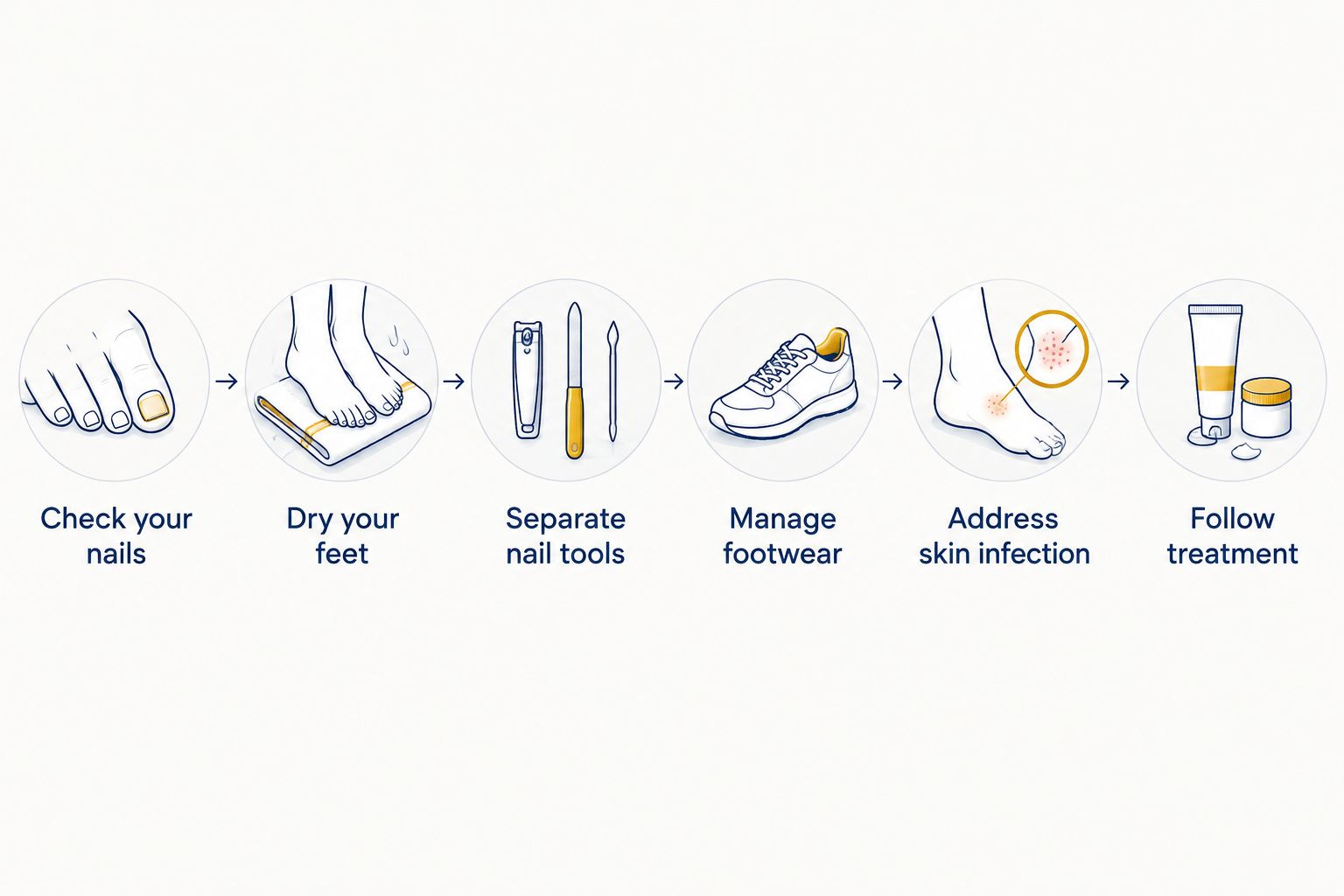Six steps to reduce fungal exposure while caring for an infected toenail