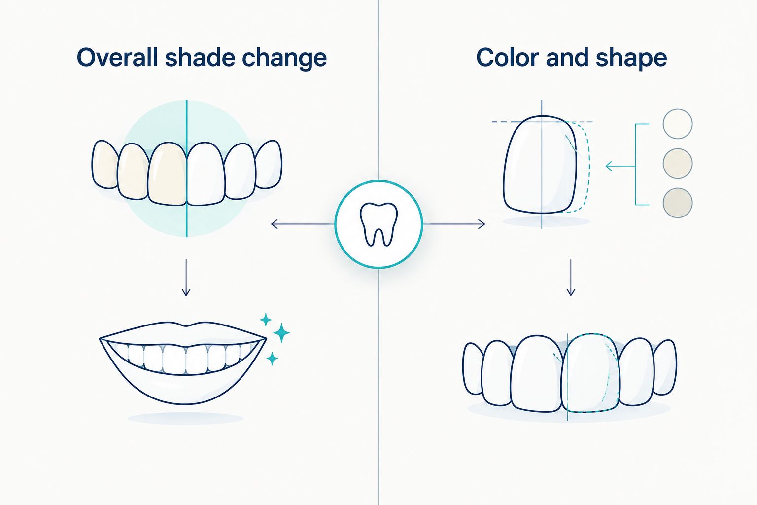 Two-column comparison of whitening for natural teeth and veneers for color and shape