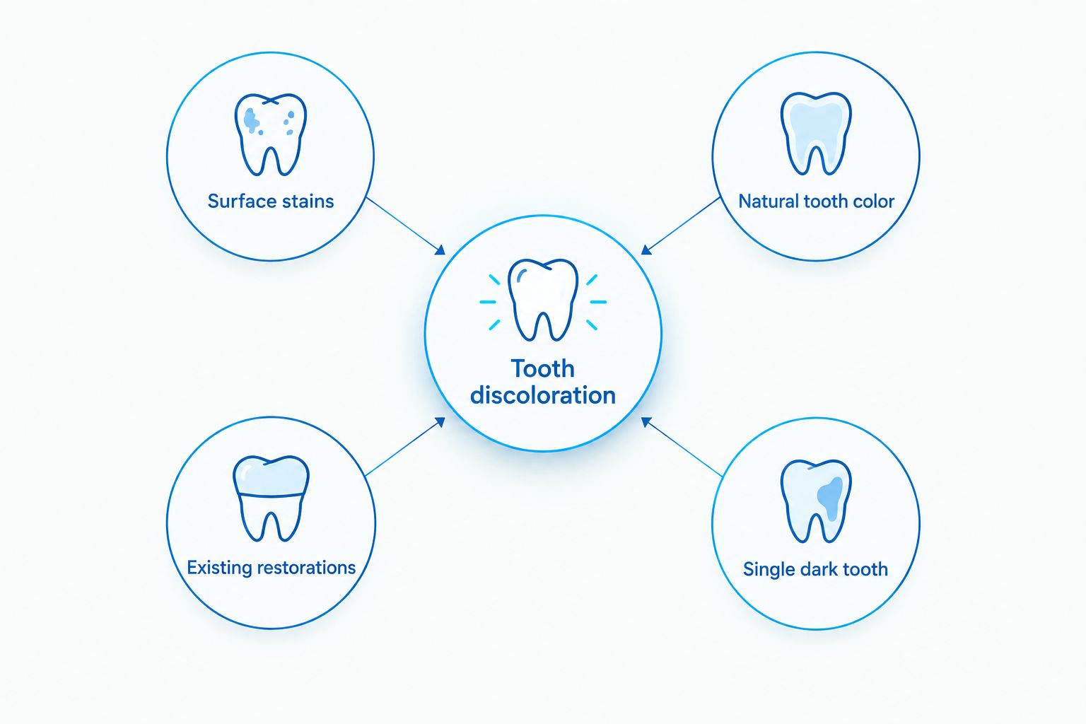 Four types of tooth discoloration that require different whitening decisions