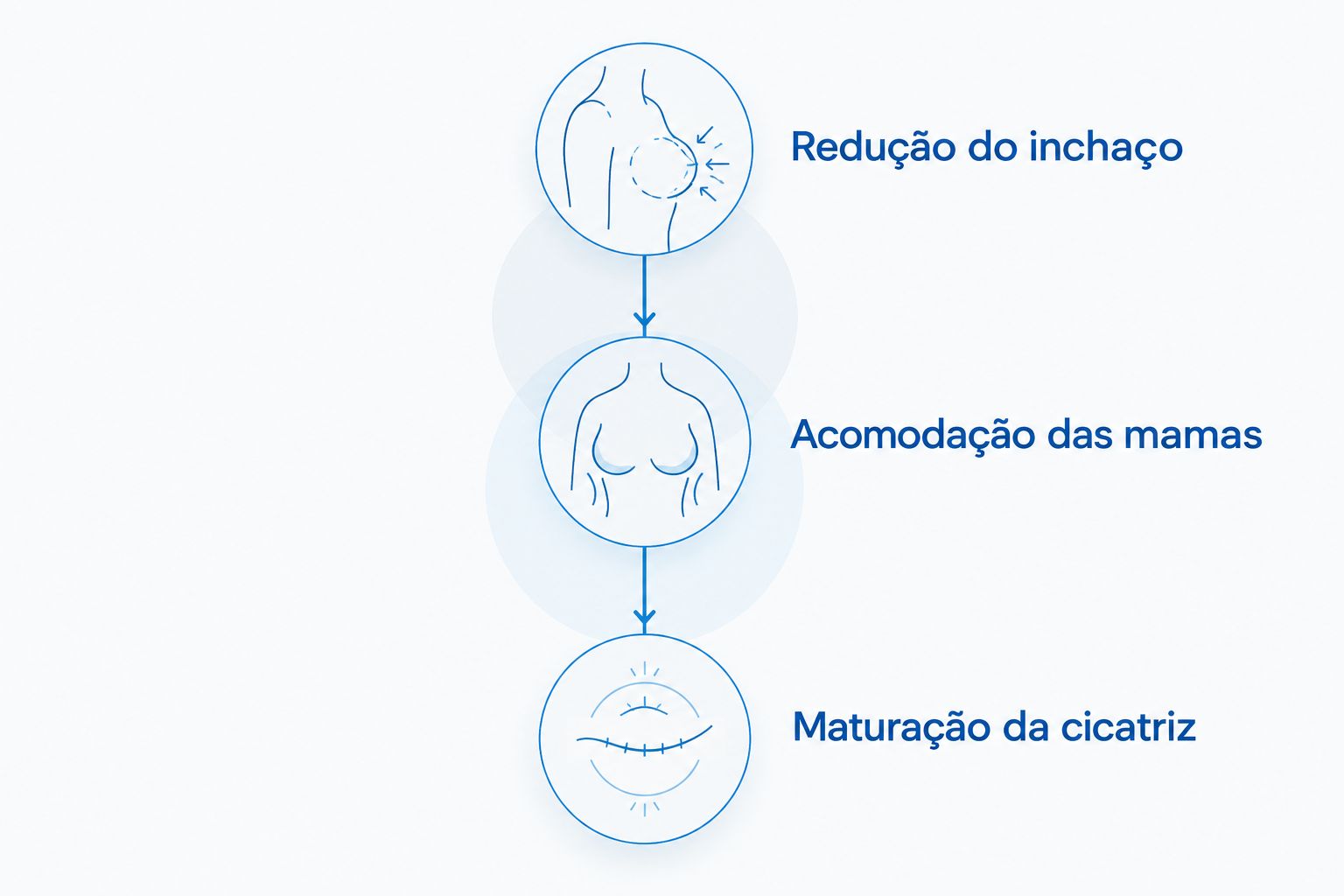 Etapas sobrepostas de redução do inchaço, acomodação das mamas e maturação da cicatriz.