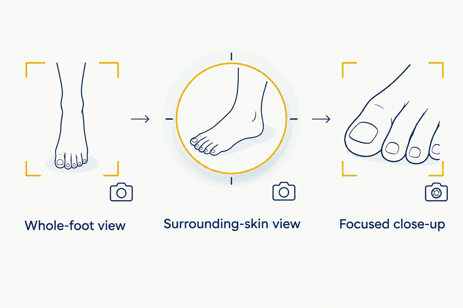 Three wound-photo views showing the whole foot, surrounding skin, and a focused close-up.
