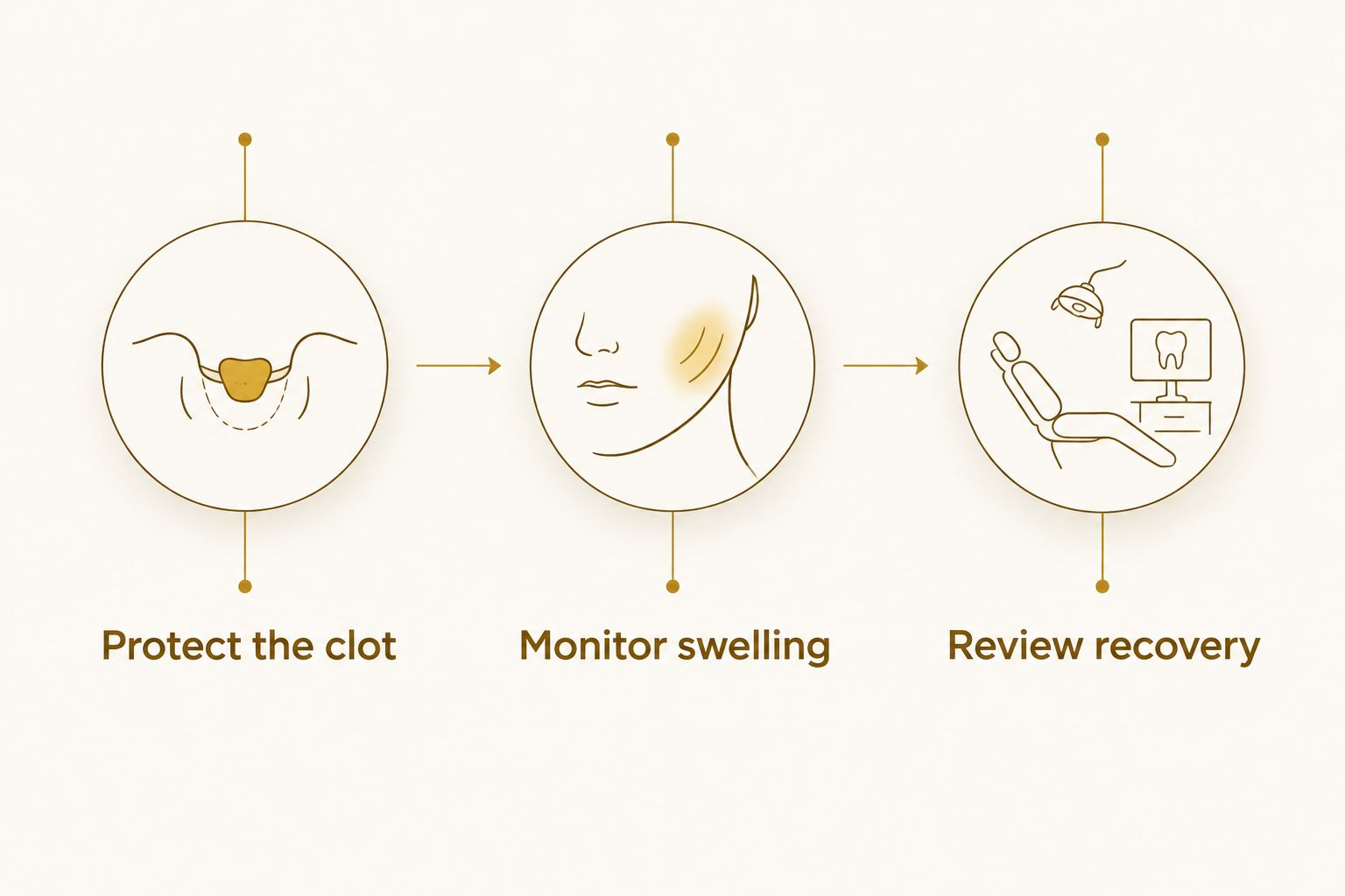 Recovery timeline showing clot protection, swelling monitoring, and a recovery review