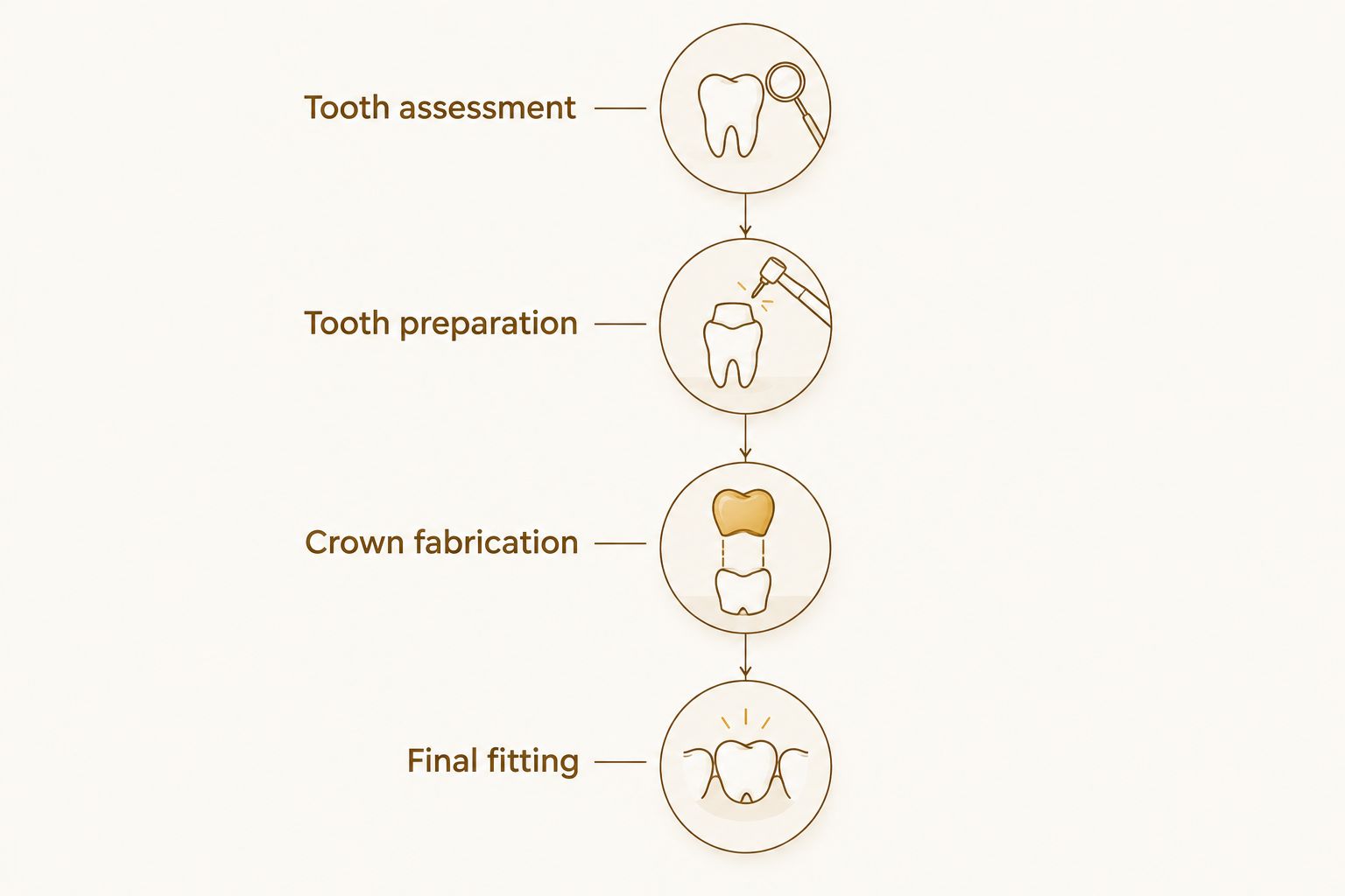 Four stages of crown treatment, from tooth assessment through final fitting.