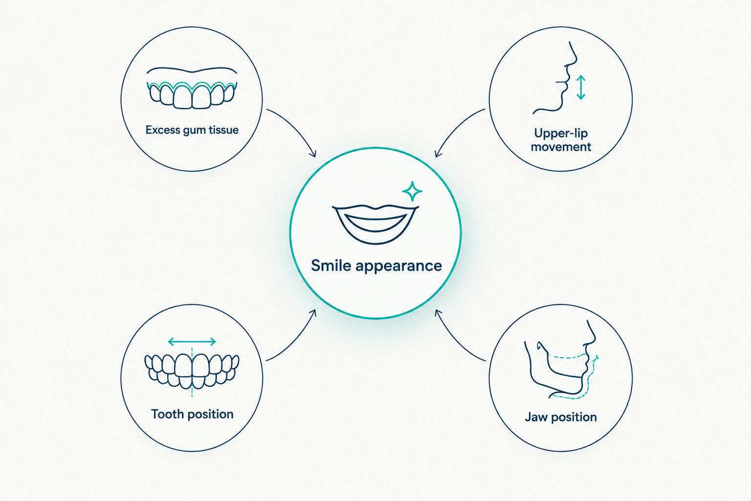 Diagram showing four possible contributors to visible gums when smiling