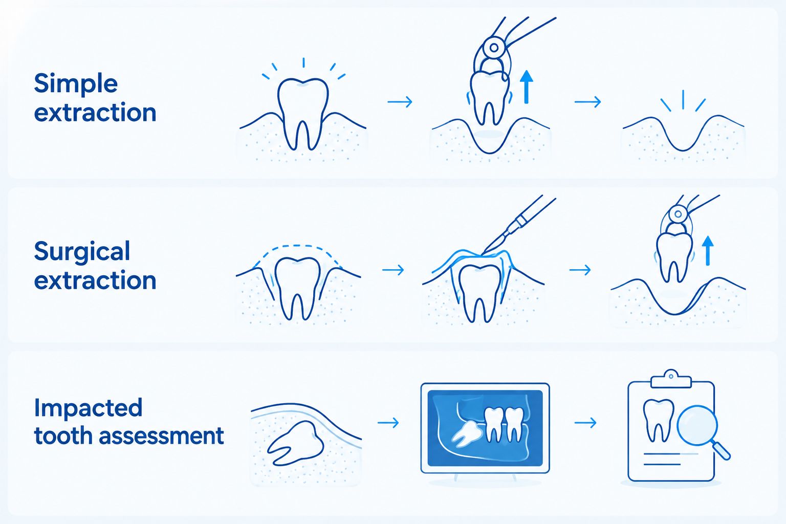 Comparison of simple extraction, surgical extraction, and impacted tooth assessment