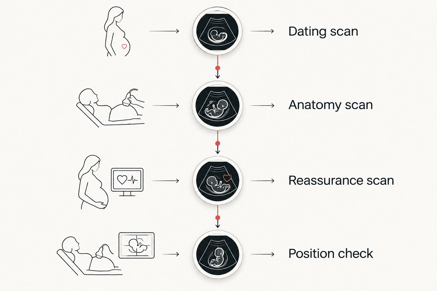 Vertical timeline of four pregnancy ultrasound scan phases