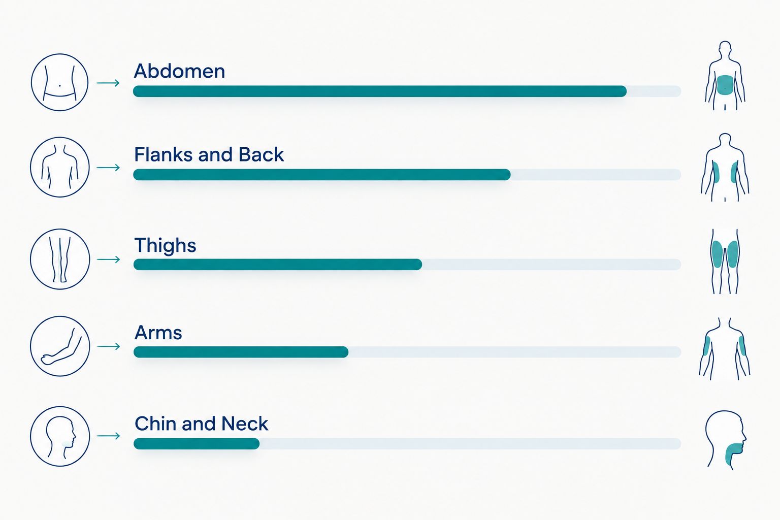 Five liposuction treatment areas ordered by relative cost tier