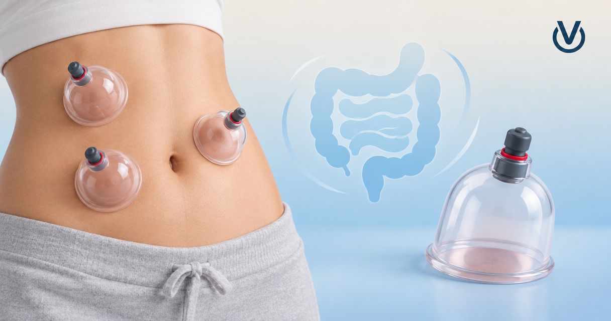 Can cupping help with bloating?