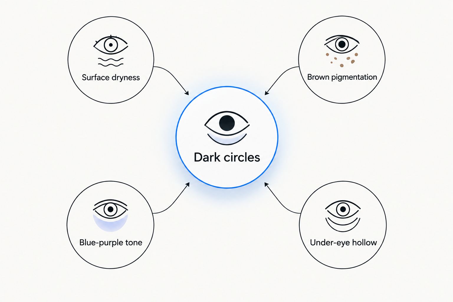 Dark circles shown with four possible contributors: dryness, pigmentation, blue-purple tone and a hollow