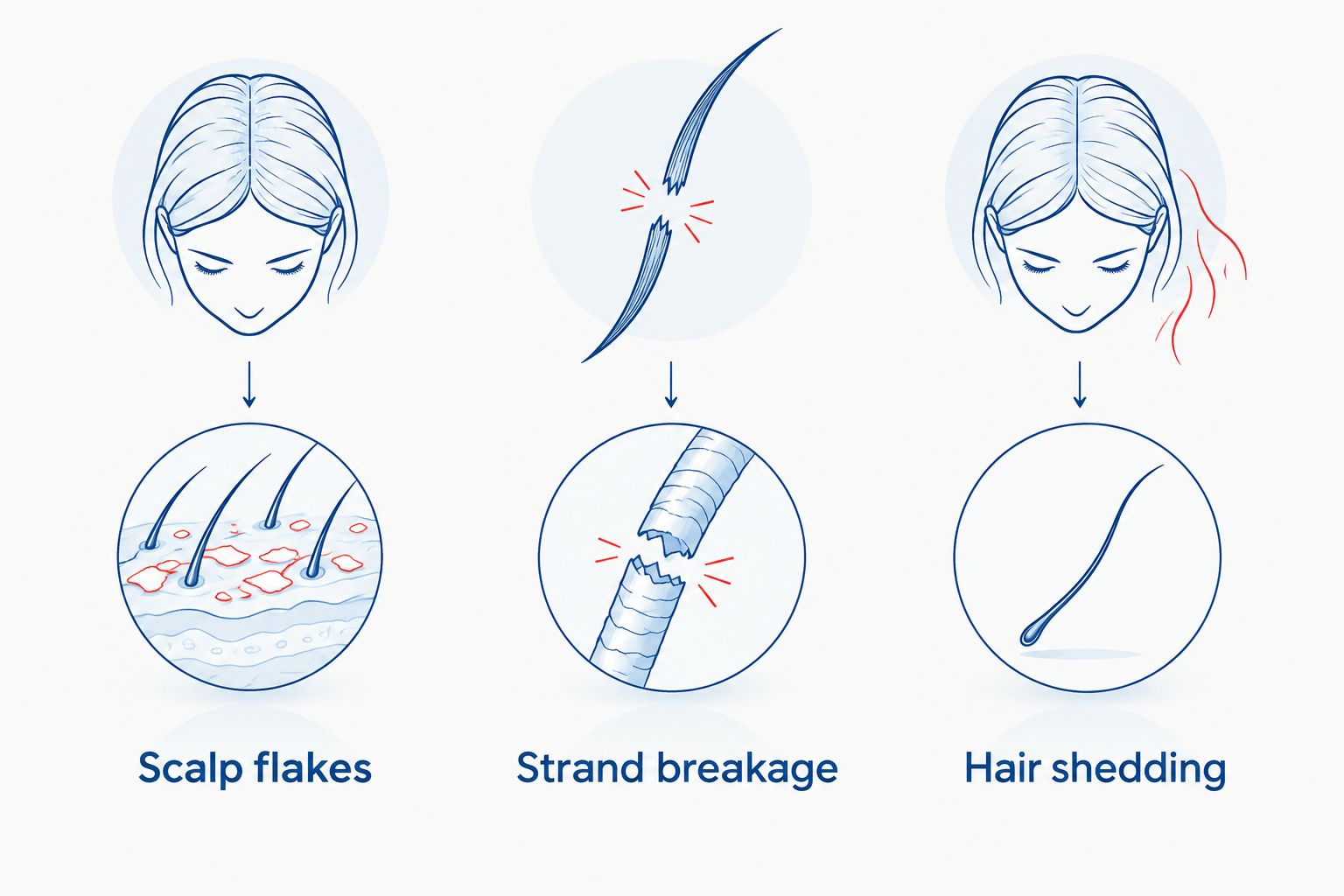 Comparison of scalp flaking, snapped hair strands and whole hairs shed from the follicle