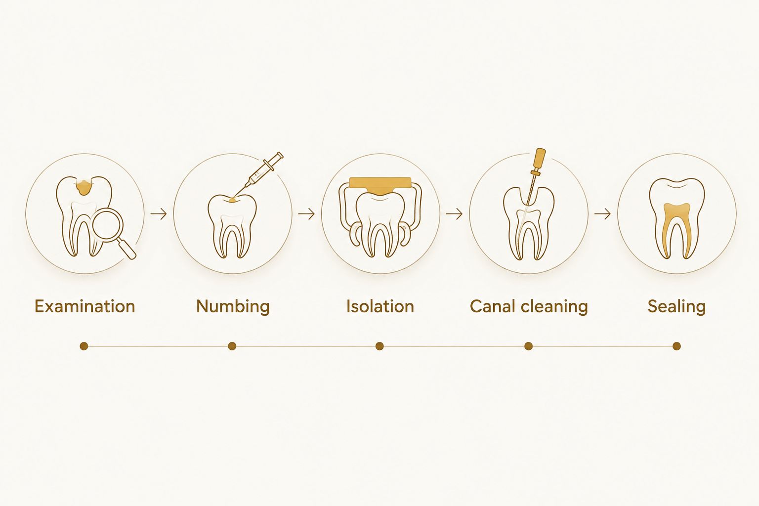 Root canal stages from examination and numbing through isolation, canal cleaning, and sealing