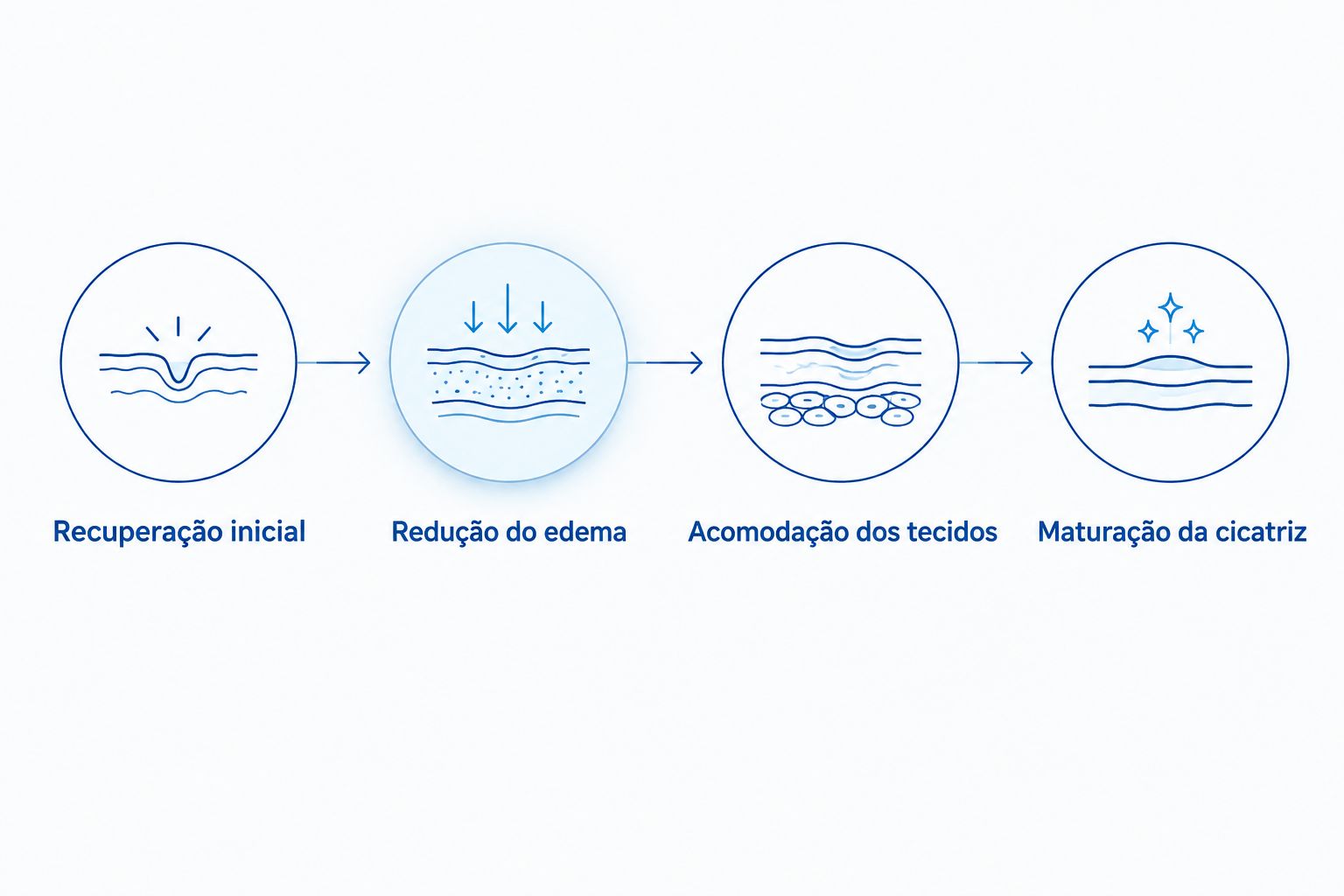 Etapas da evolução após blefaroplastia, da recuperação inicial à maturação da cicatriz.