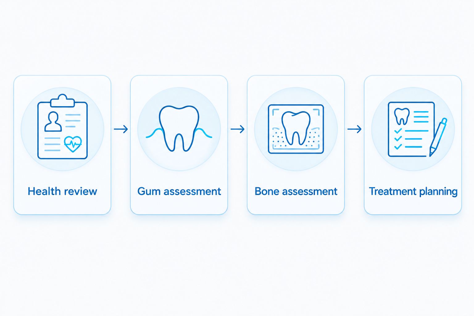 Four stages of an implant assessment, from health review to treatment planning