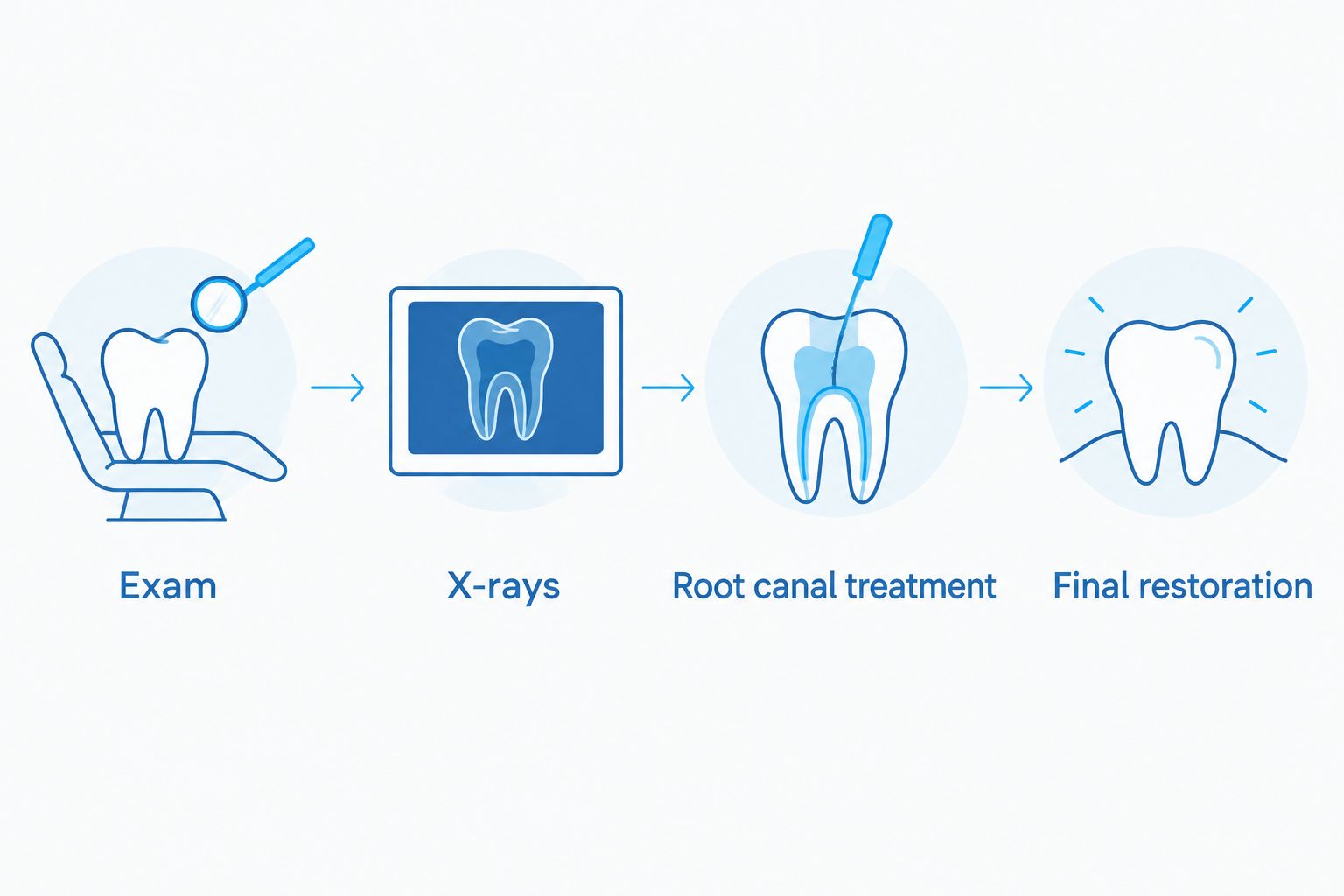Four parts to check in a root canal estimate: exam, X-rays, treatment and final restoration