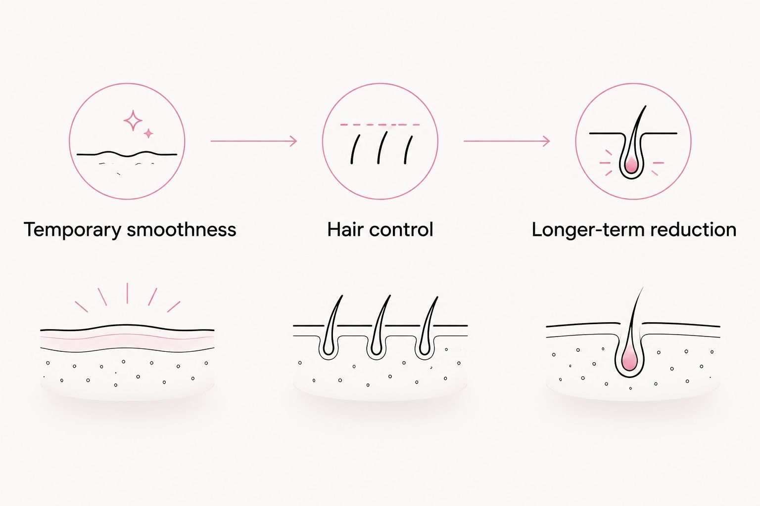 Three grooming goals: temporary smoothness, hair control, and longer-term reduction